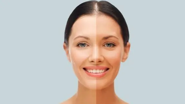 Skin Whitening Facial Skin Whitening Facial